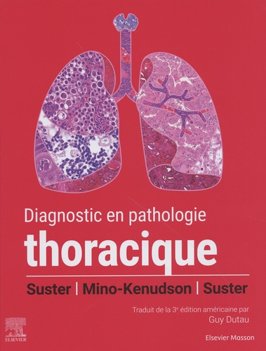 Diagnostic en pathologie thoracique