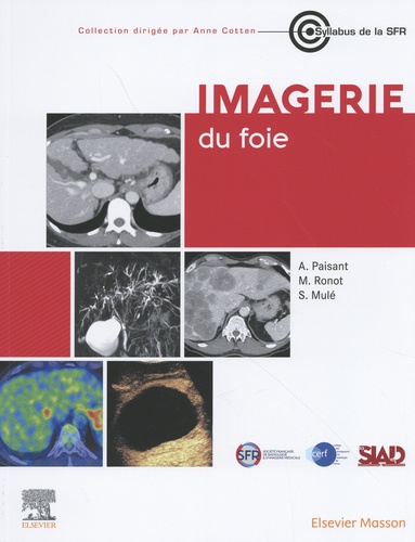 Imagerie du foie