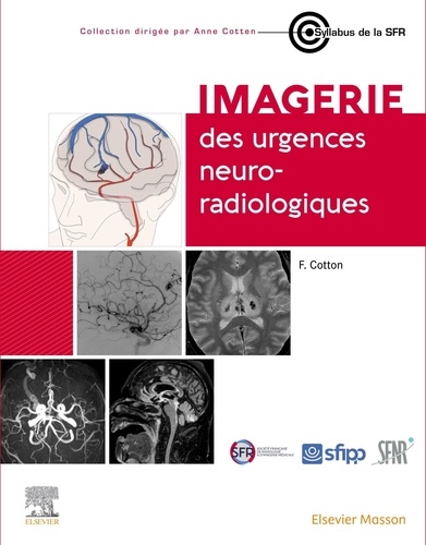 Imagerie des urgences neuro-radiologiques