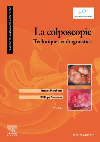 La colposcopie. 5e édition