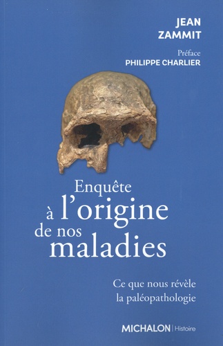 Enquête sur l'origine de nos maladies. Ce que nous révèle la paléopathologie