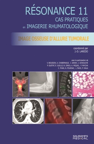 Imagerie osseuse d'allure tumorale. Cas pratiques en imagerie musculosquelettique