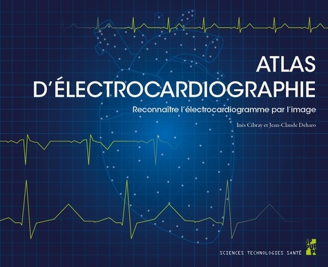 Atlas d’électrocardiographie. Reconnaître l’électrocardiogramme par l’image